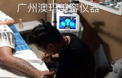 美國蜂巢皮秒多少價位?洗紋身機(jī)器什么牌子_一臺洗紋身機(jī)多少錢