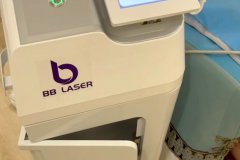 BB laser素顏光國內(nèi)哪個(gè)生產(chǎn)廠家比較好？進(jìn)口素顏光設(shè)備代理商